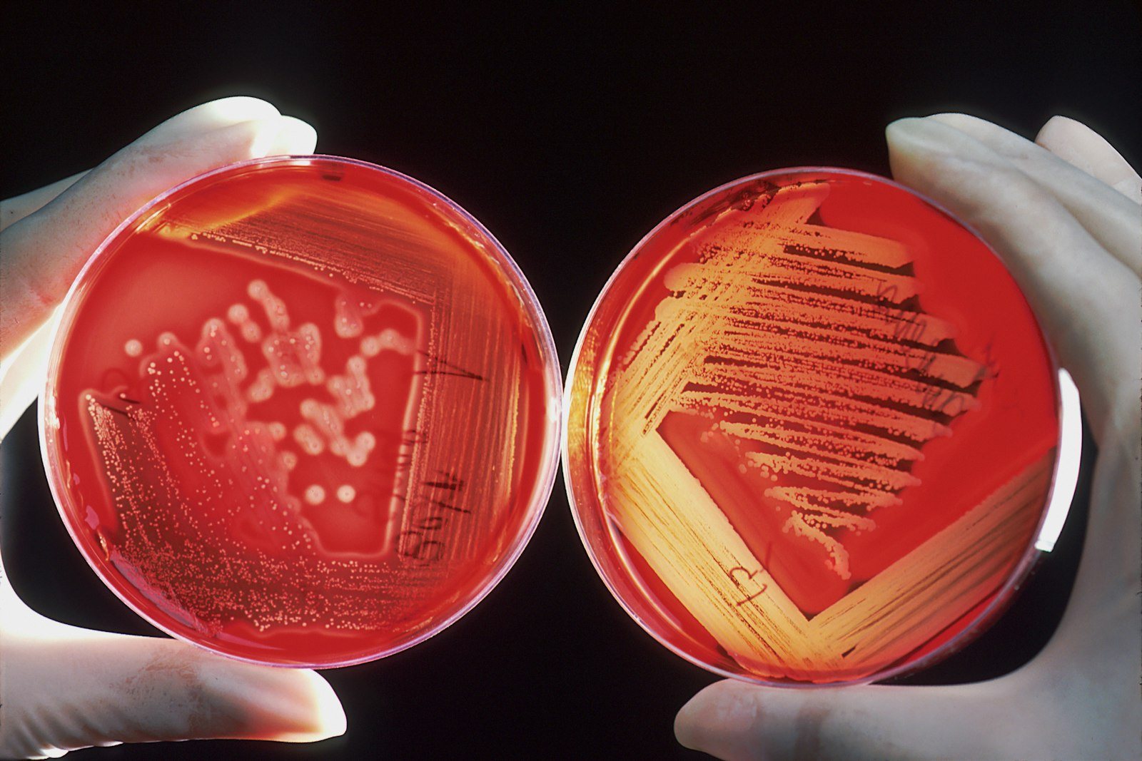 A bacterial culture on an agar plate