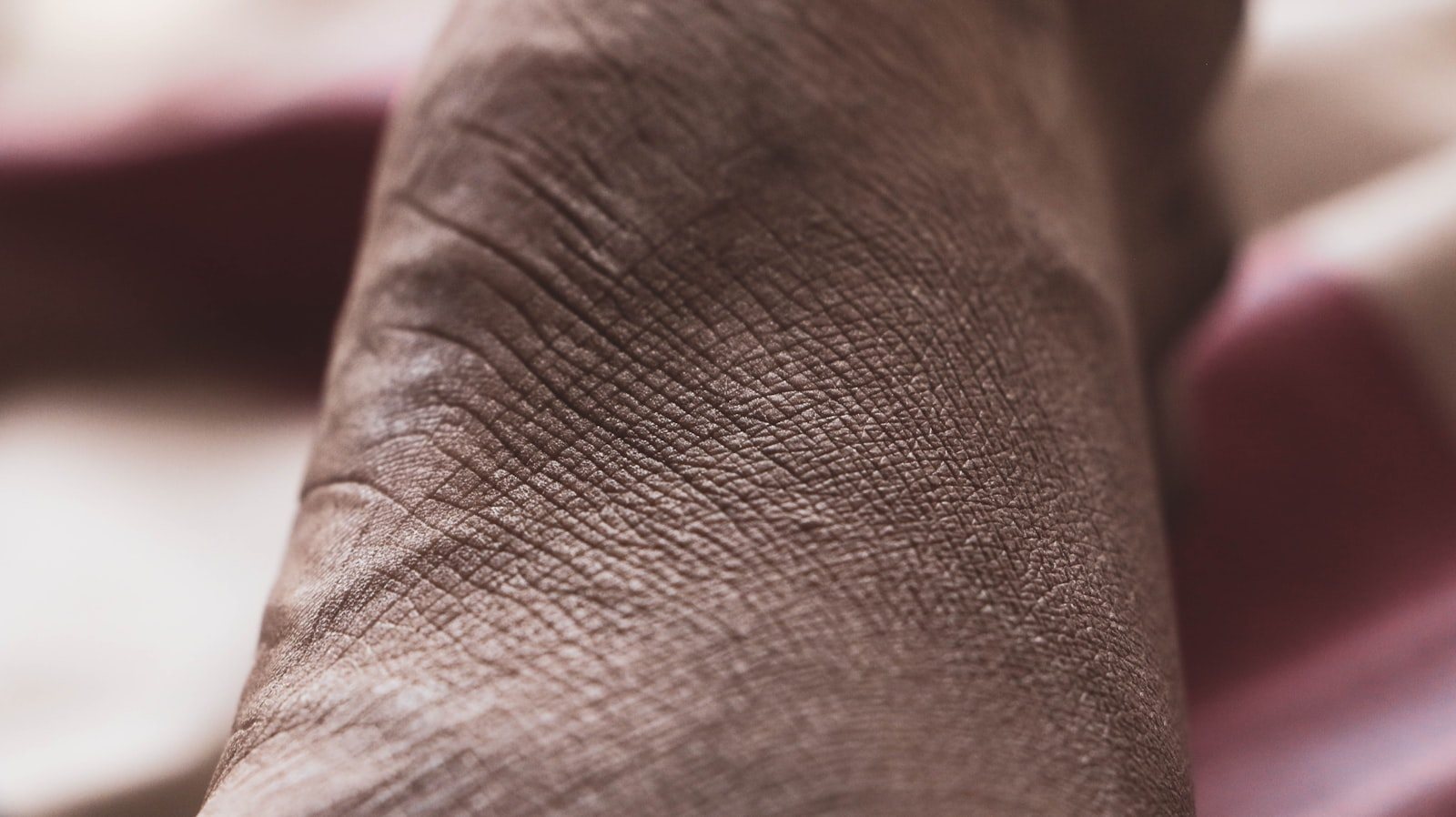 A blister on the heel seen close up