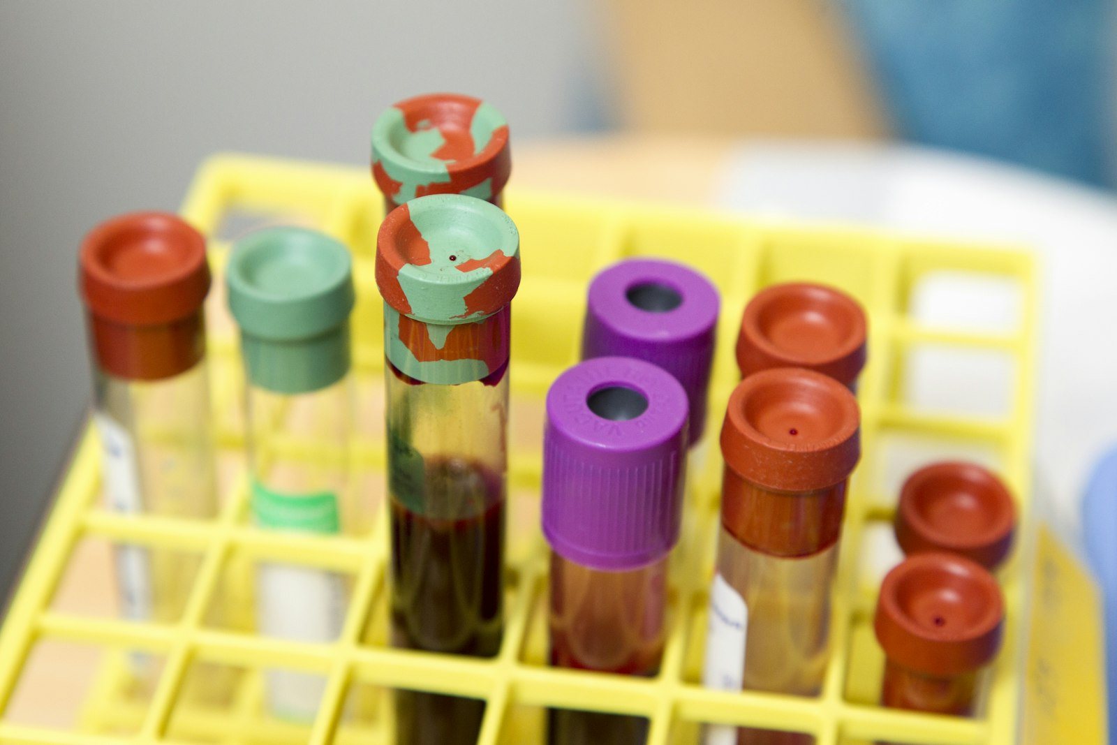 Blood samples prepared for routine testing