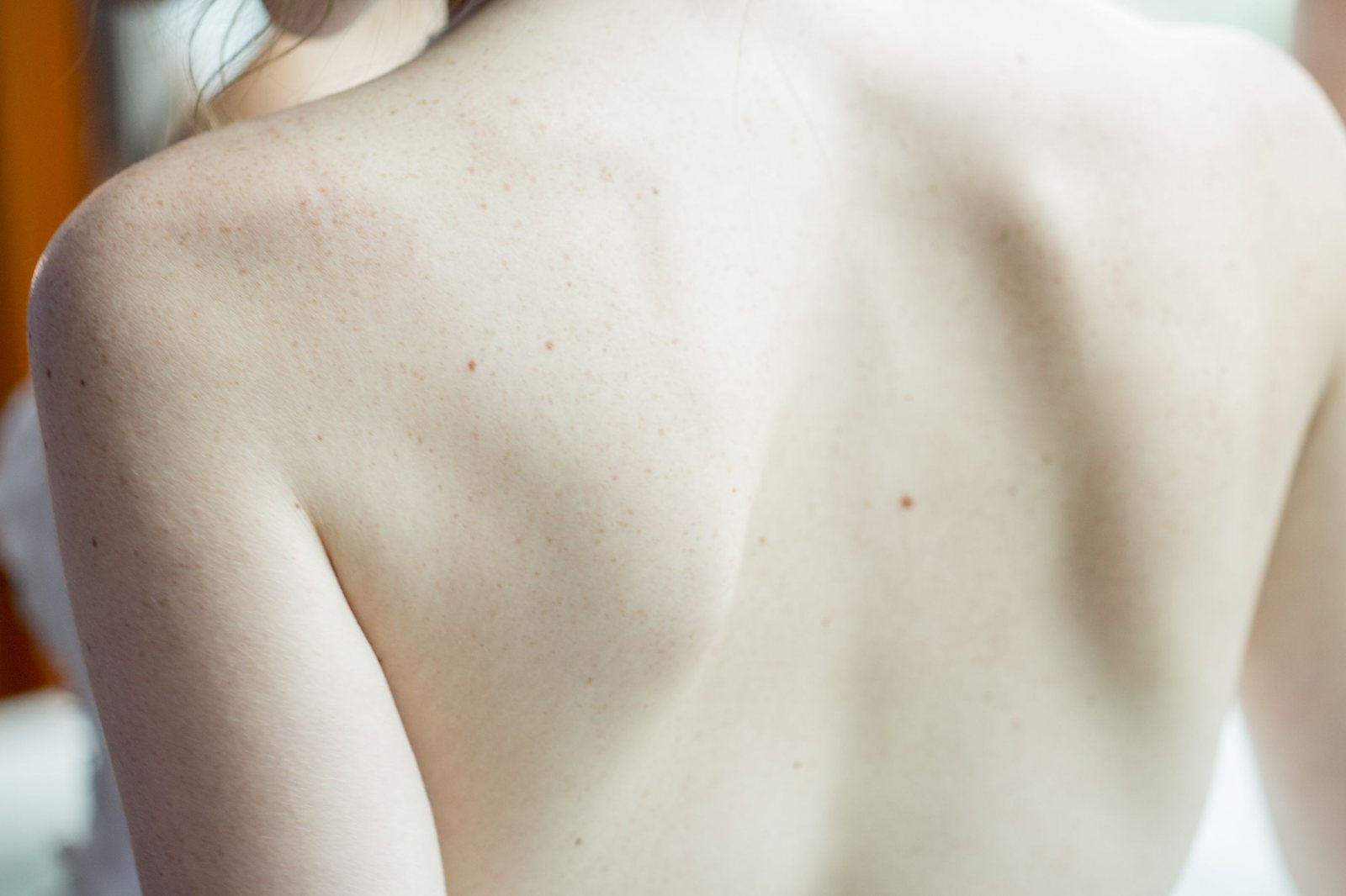 A skin rash seen close up
