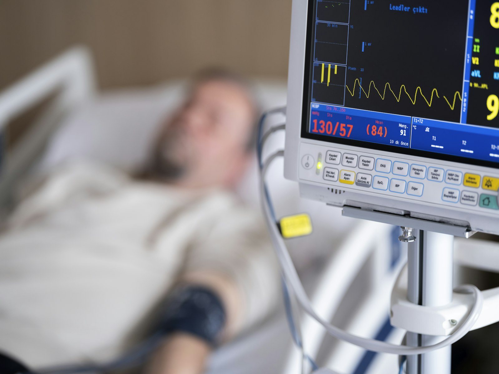 A monitor displaying vital signs
