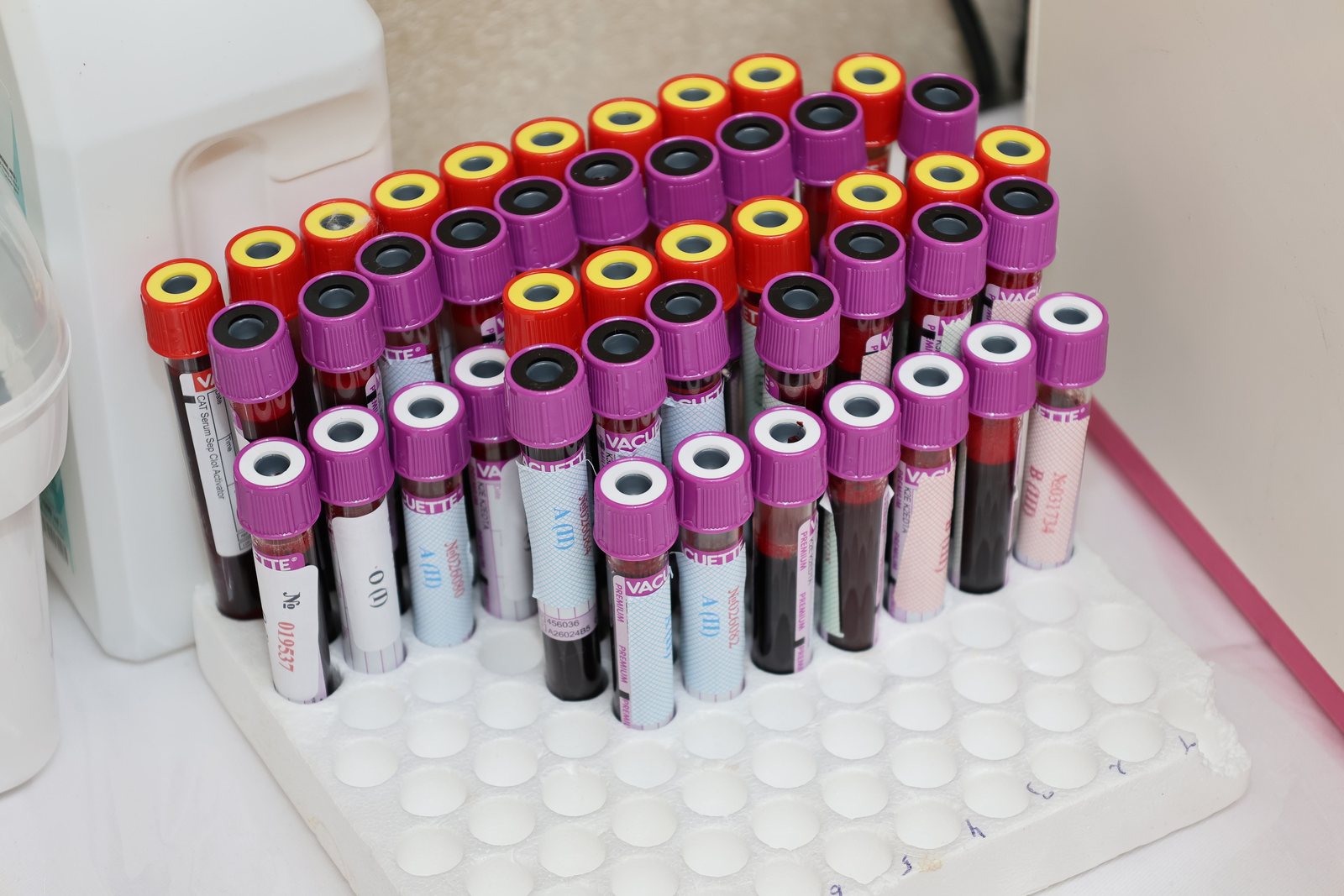 Rows of blood sample vials in a laboratory
