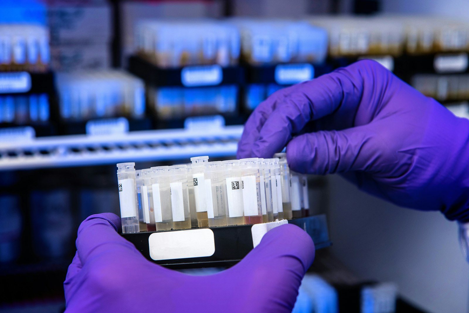A blood sample being handled in a laboratory