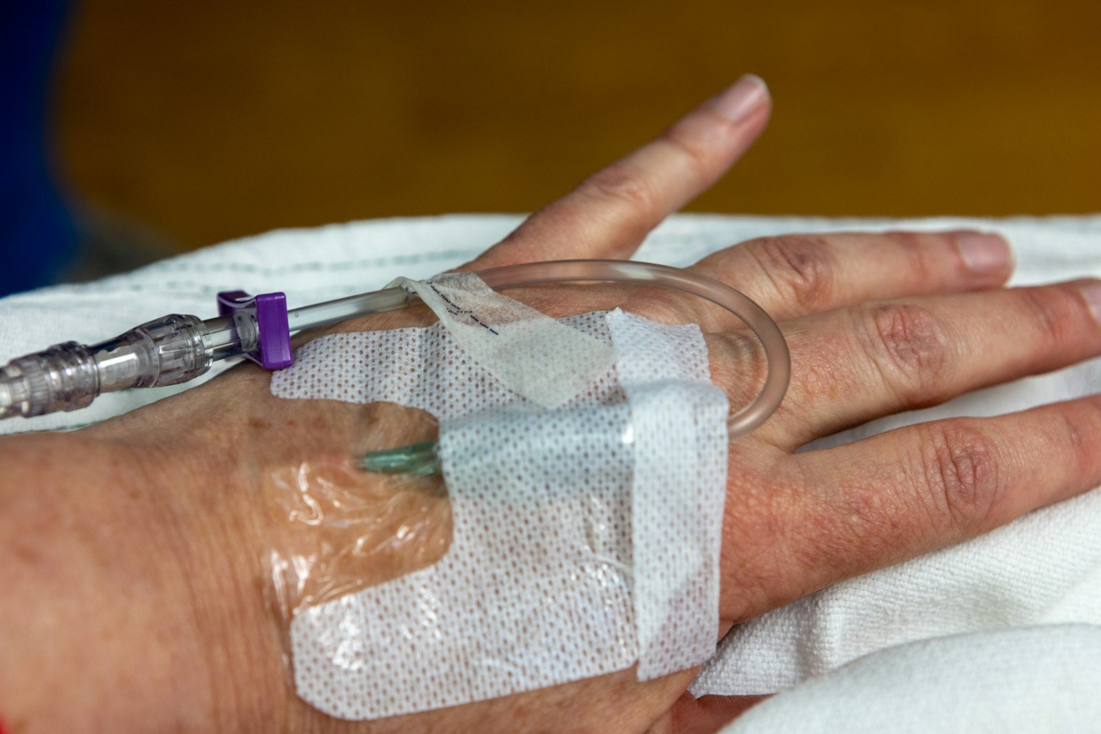 An intravenous cannula taped to a hand